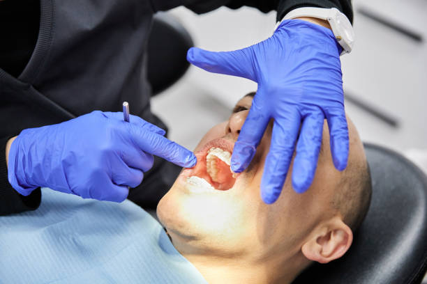 Best Emergency Dentist for Knocked-Out Tooth in Baldwin, NY